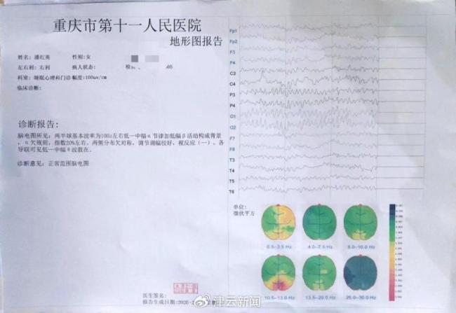 重慶女子兩次“被精神病”收治 161天的無奈與抗?fàn)?/></p><p>2024年，潘紅英與梁某的婚姻走到盡頭，雙方因離婚事宜矛盾升級。當(dāng)年4月15日，潘紅英找到梁某索要孩子伙食費，引發(fā)爭執(zhí)，梁某前往大溪溝派出所。當(dāng)天下午，十余名街道、社區(qū)工作人員與警務(wù)人員一同進(jìn)入潘紅英住所，將她帶往渝中區(qū)精神衛(wèi)生中心。這次，她被強制收治126天，加上之前的35天，累計161天。</p><p class=