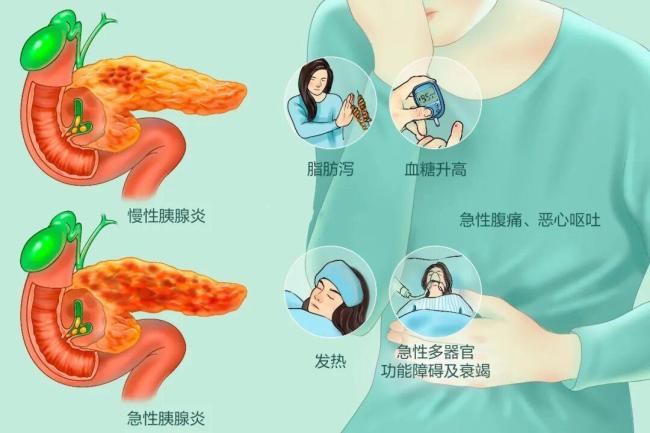 女子餓6吃1誘發(fā)重癥胰腺炎 極端節(jié)食后的暴食危機