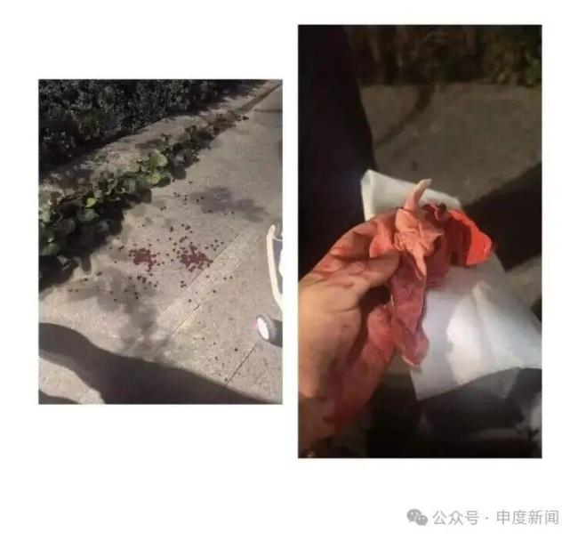 男子被商场高空坠物砸头缝4针