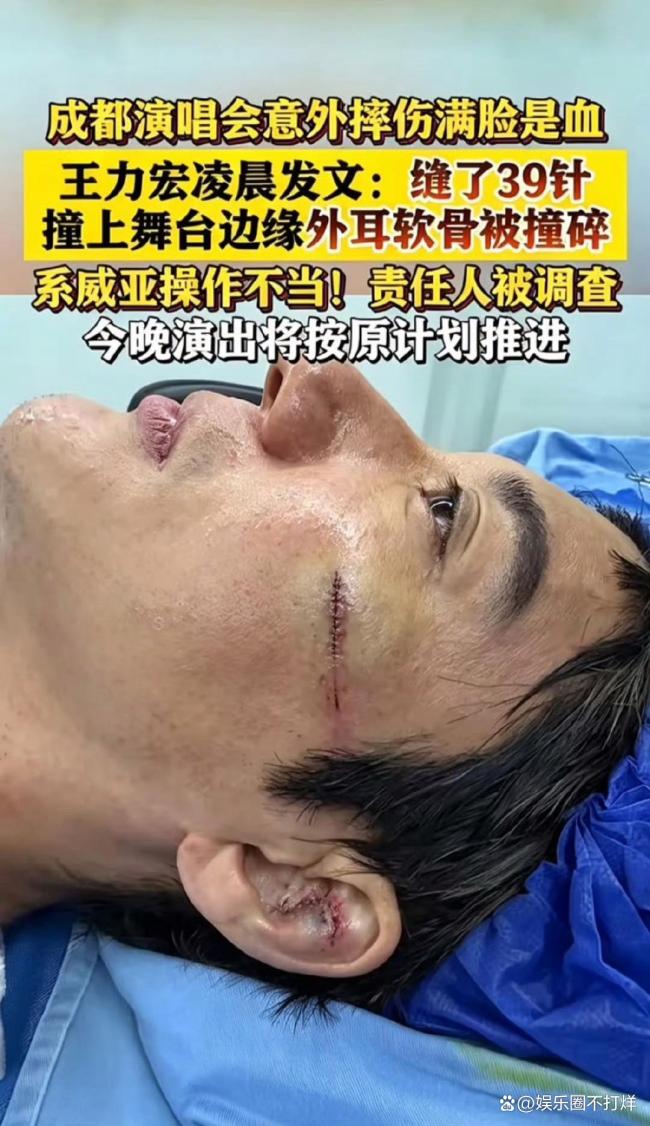 王力宏缝39针不该成失职方遮羞布 敬业不应掩盖安全疏漏