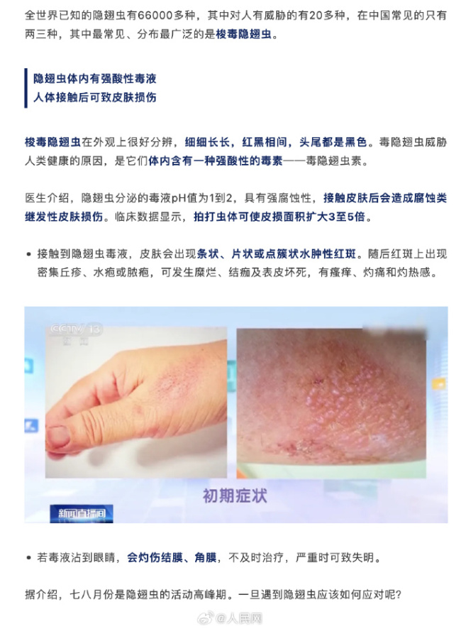 注意！遇见隐翅虫不要用手拍 如何避免被隐翅虫盯上