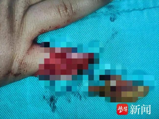 两岁女童坐商场滑梯夹断小拇指 安全隐患引关注