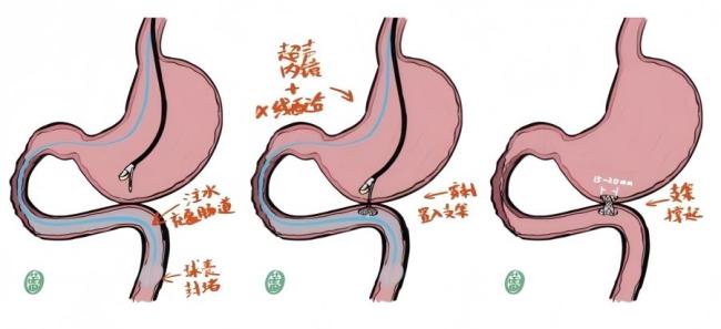 中西医联手为患者打通生命通道