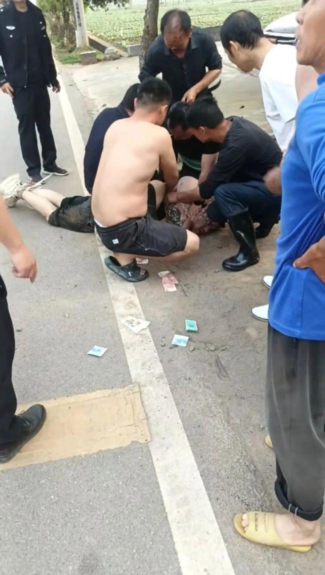 施暴者咬掉见义勇为者鼻子吞入肚中 致敬平凡英雄