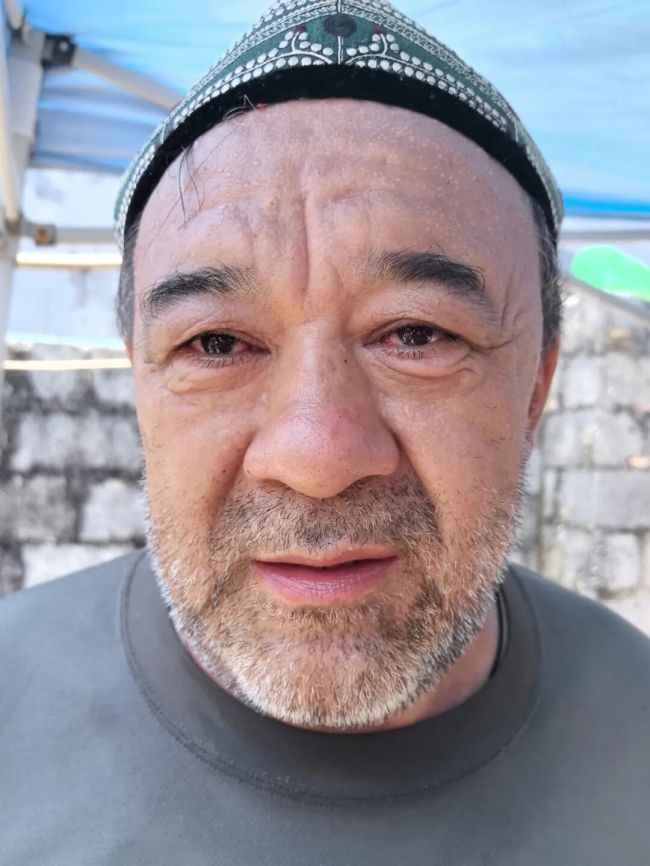 阿里木腰部起疹眼睛泛红仍为灾区做饭 爱心跨越千里