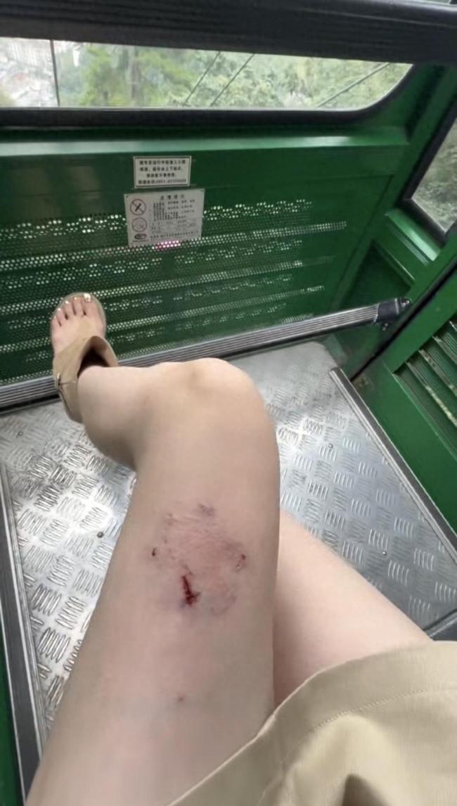 贵州黔灵山公园猴子每天约伤10人