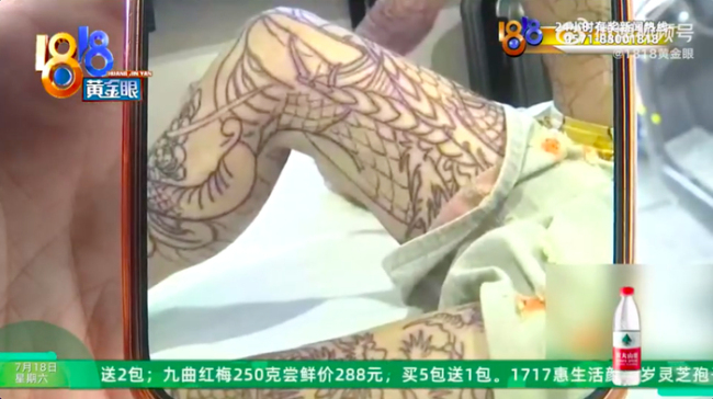 14岁少年文身成大花腿 家属索赔20万