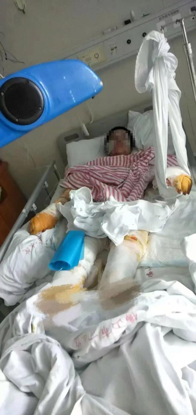 佛山泼硫酸男子被执行死刑 罪有应得获刑终章