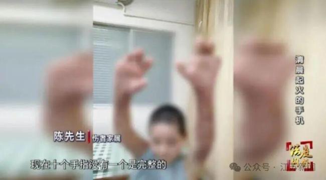 女子充电刷手机睡着被烧伤 手机电池热失控引发火灾