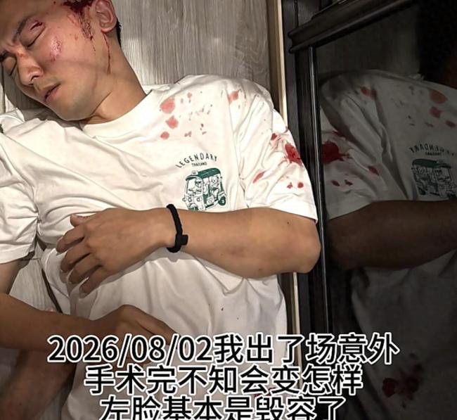 演员陈威翰遇到严重车祸左脸受伤