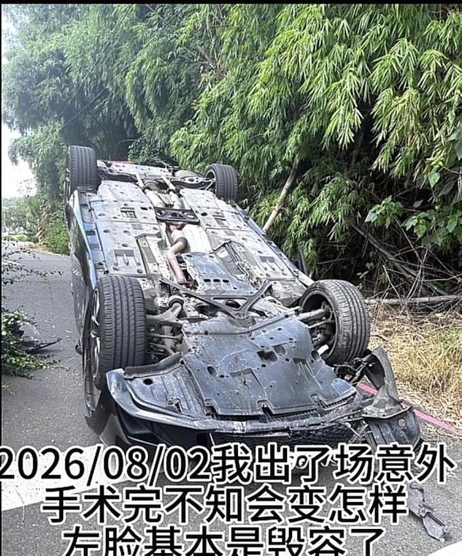 演员陈威翰遇到严重车祸左脸受伤 左眼失明风险引担忧