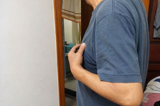 61岁大爷胸前长痘确诊乳腺癌