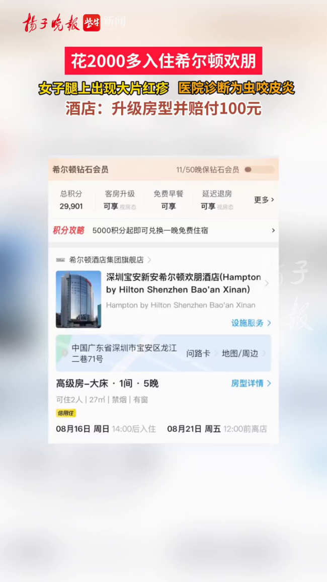 花2000住希尔顿 腿上出现大片红疹