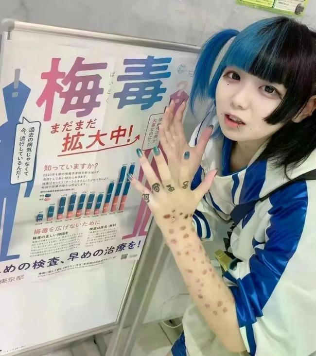 日本为何会出现梅毒疫情 药物短缺与社会因素交织
