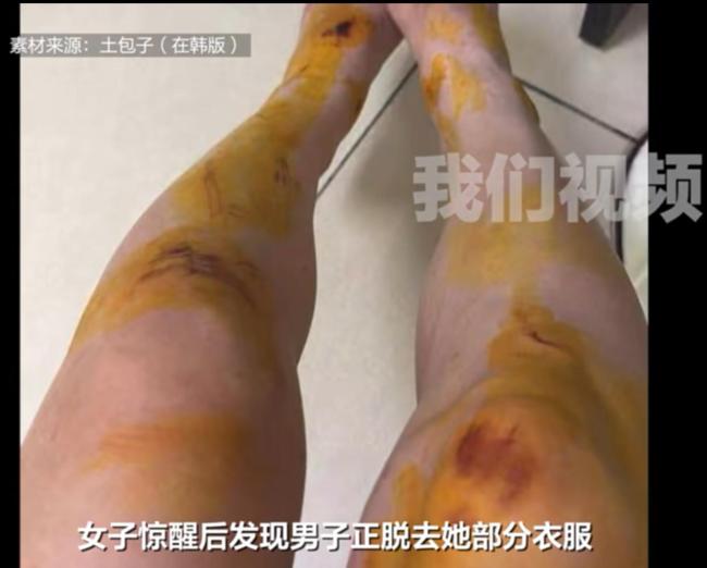 女子在马来西亚为躲侵害藏灌木丛一夜