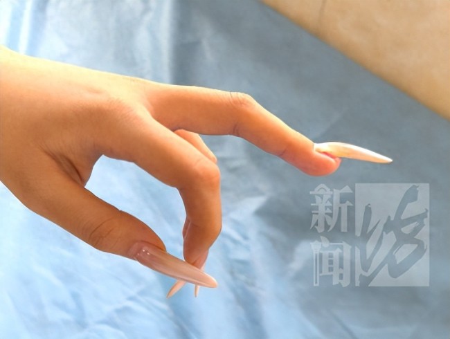 女子做超长美甲睡觉翻身连根折断 欧气爆棚传说奖