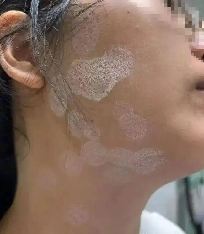 4员工办公室午休被蝙蝠咬伤安全防护引关注_中华网(图1)