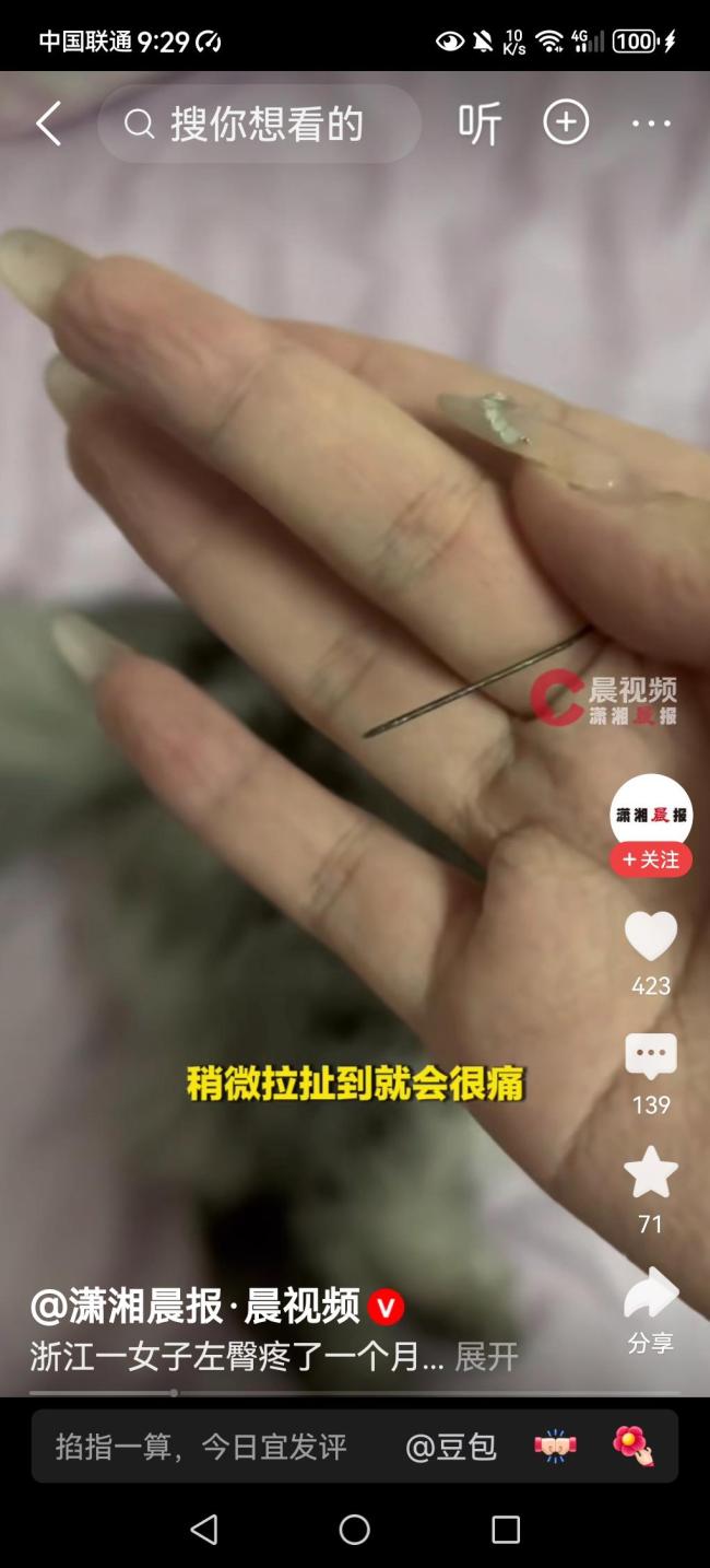 臀部取出针头女子每天骑共享单车 异物潜伏一个月