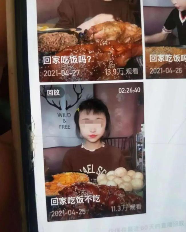吃播女网红去世前多次展示手背上的针眼 暴食症下的悲剧