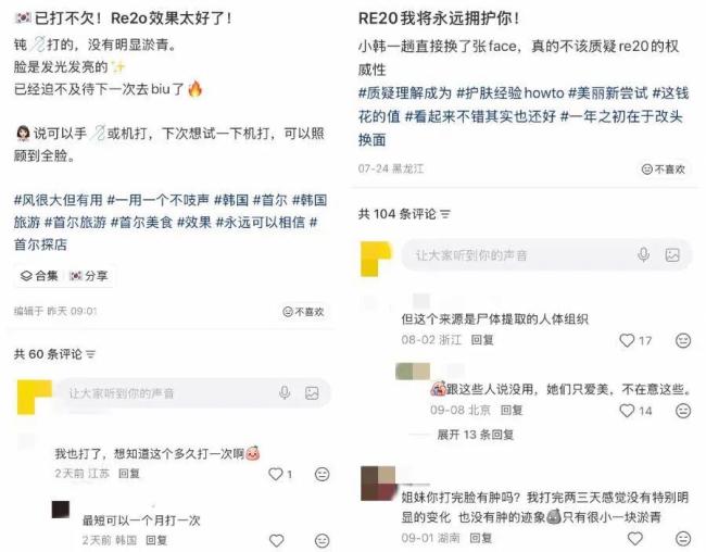 网友称注射尸皮针后脸上仿佛发霉 争议产品引关注