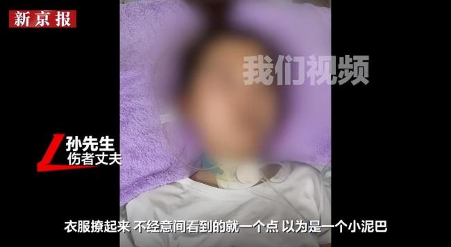 女子被蜱虫咬伤后确诊森林脑炎