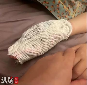 肇庆9岁自闭症儿童遭殴打 2名老师被刑拘