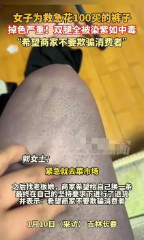 女子花百元买的裤子掉色 双腿被染紫 购物遭遇尴尬