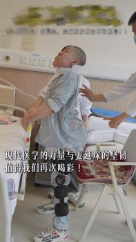 00后“折疊男孩”4次手術(shù)后終能直立 毅力書寫奇跡