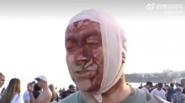 以色列律师分享在澳遭遇枪击后照片！