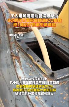 工人被呛柴油6小时现大面积白肺 一口柴油引发急性肺炎