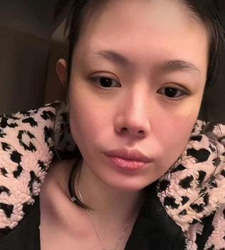 汪峰前妻自曝被男友暴打 已宣布分手 直播揭露家暴真相