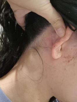 多方回应中国女子在澳遇袭 种族歧视事件引关注