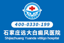 石家庄白癜风哪里看的好