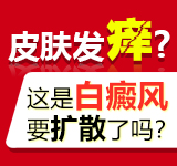 男性有了白癜风会出现什么症状?