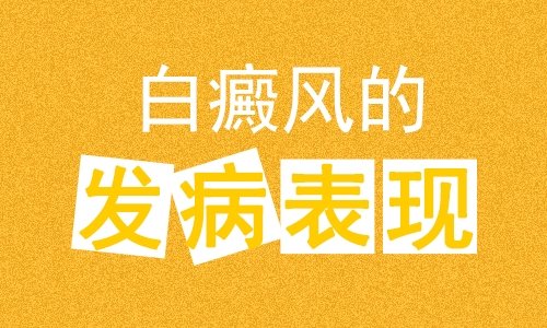 白癜风不及时治疗会有什么危害 焦作白癜风专科医院专业治疗