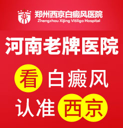 郑州西京白癜风专科医院如何*治疗寻常型白癜风