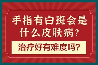 昆明到看哪里有治白斑的-儿童手上白斑可以用308吗