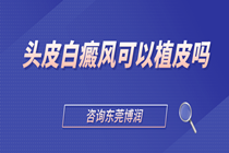 头皮白癜风可以植皮吗?东莞博润简介