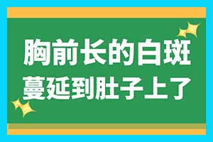 昆明白癜风医院哪家好