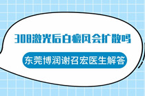 308激光后面部白癜风会扩散吗-惠州白癜风医院308激光治疗白癜风效果