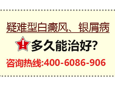 银屑病年有望攻克-银屑病2020年被攻克