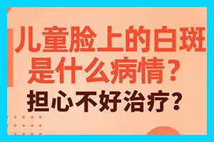 昆明口碑白癜风医院电话-白癜风治疗和患者心理健康有关系吗