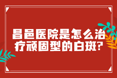 昌邑医院是怎么治疗顽固型的白斑