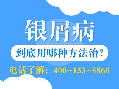 佳木斯哪里治疗银屑病较好-佳木斯哪里看银屑病好