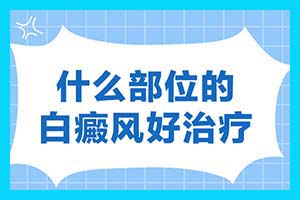 〔白斑擦什么药膏好〕怎么判断是不是白癜风