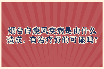 烟台白癜风疾病是由什么造成 有治疗好的可能吗