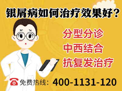 老是长癣是怎么回事_身上老起癣是什么回事