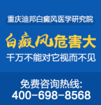 重庆治疗白癜风的专科医院排名 老年人出现白癜风需要注意什么