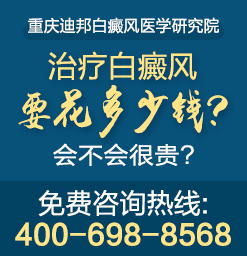 导致白癜风扩散的原因有哪些-重庆哪个医院治白癜风比较好