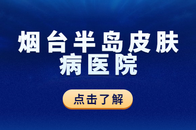 烟台皮肤病治疗的医院有哪些是靠谱的-牛皮癣是会传染的吗